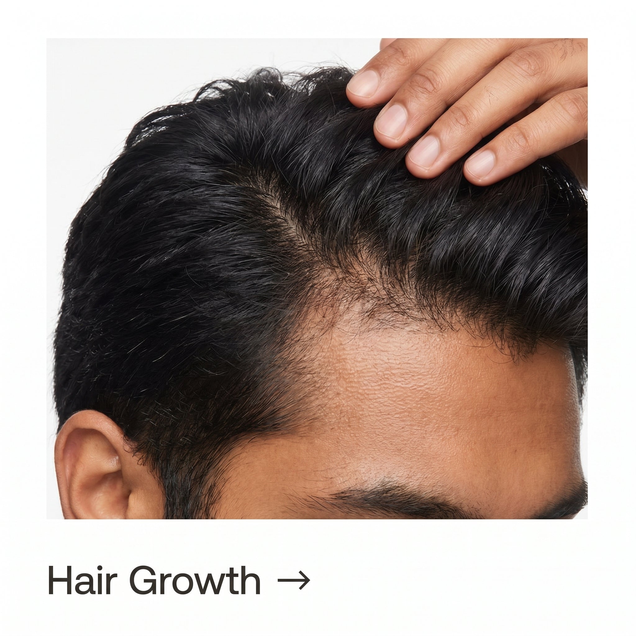 Hair Growth